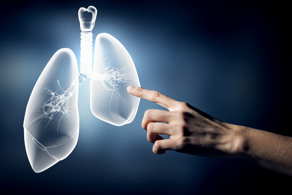 Ảnh 2 của Viêm phổi không điển hình